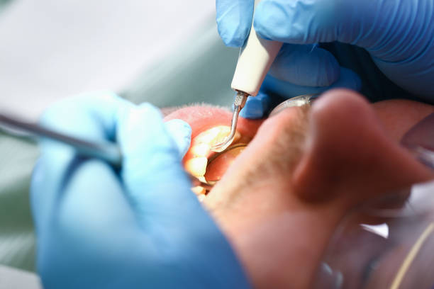 Best Emergency Dental Care for Trauma or Injury in Ste Genevieve, MO