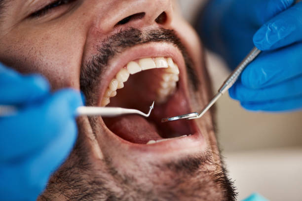 Best Emergency Broken Tooth Repair in Ste Genevieve, MO